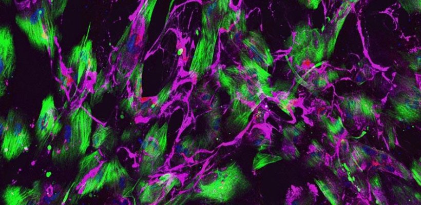 Diseased mural cells stained for calponin (mural cells marker, green), collagen...