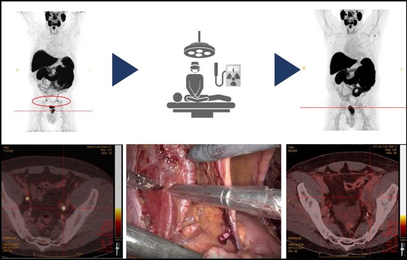 Graphical Abstract: Preoperative (left; top and bottom) and postoperative...