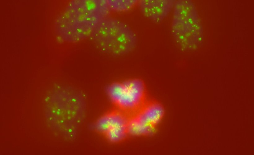 In Neuroblastomen läuft die Zellteilung aus dem Ruder: Statt Chromosomen...