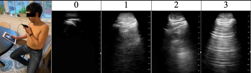 A volunteer study participant applies an ultrasound probe to their abdomen