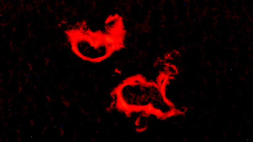 Congo red staining of liver tissue reveals differences in the vascular...